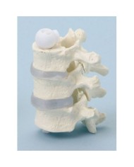 Erler Zimmer, modello anatomico di vertebre toraciche, a montaggio elastico