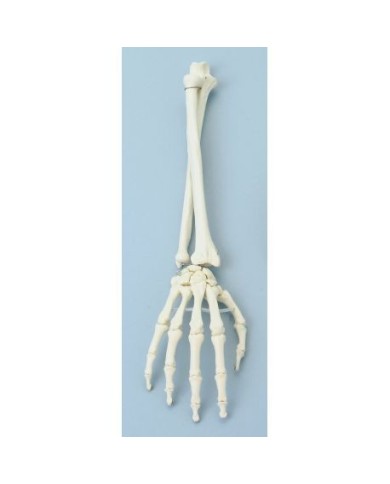 Erler Zimmer, modello anatomico funzionale di articolazione della mano e del braccio inferiore 6008 Erler Zimmer, modello anatomico funzionale di articolazione della mano e del braccio inferiore 6008