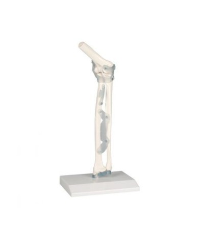 Erler Zimmer, modello anatomico funzionale di articolazione del gomito, con legamenti, su stativo