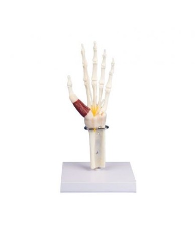 Erler Zimmer, modello anatomico di mano e polso con sindrome del tunnel carpale Erler Zimmer, modello anatomico di mano e polso con sindrome del tunnel carpale