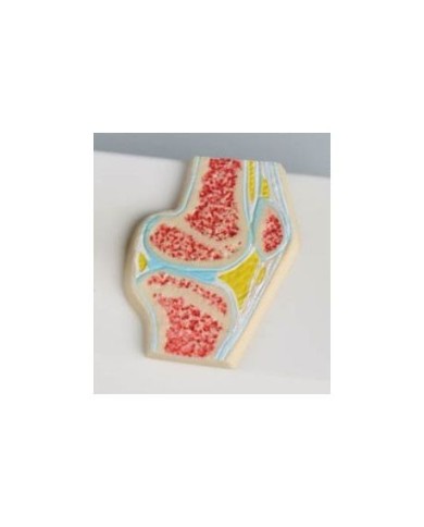 Erler Zimmer, modellino anatomico di articolazione del ginocchio, con sezione trasversale 4522