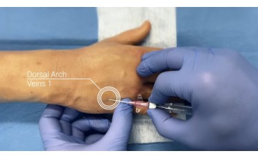 Puncture Pete: quando la simulazione endovenosa diventa iperrealistica