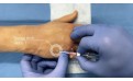 Puncture Pete: quando la simulazione endovenosa diventa iperrealistica